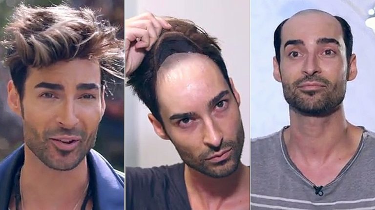 El montaje de Miguel de Gran Hermano al descubierto: sus compañeros le recriminan que no es calvo