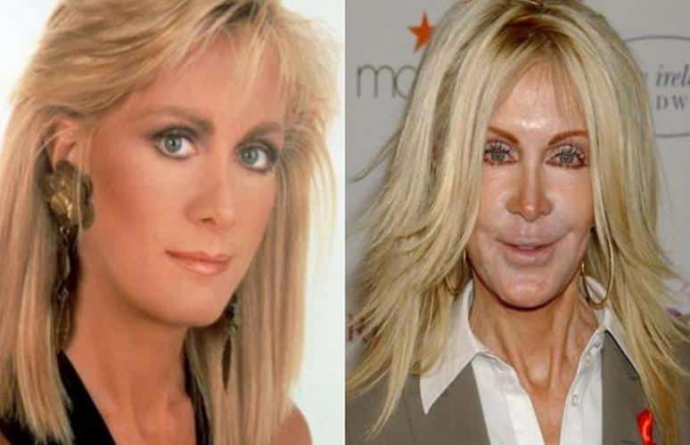 joan van ark